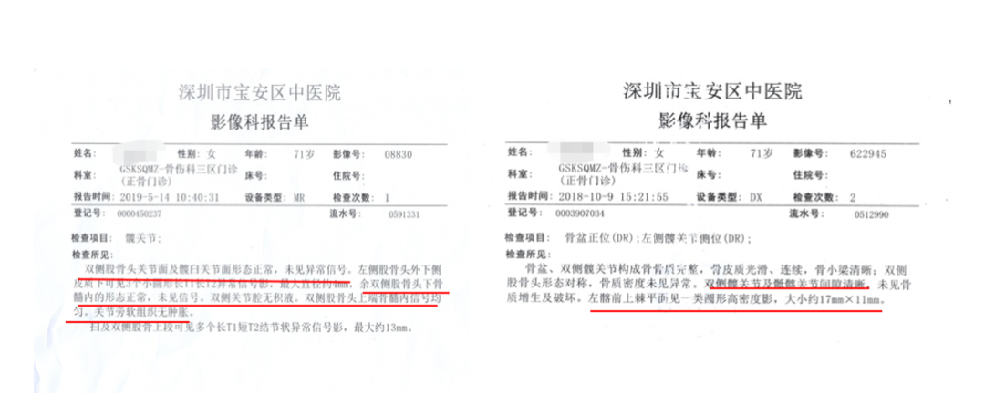 一半的致殘率！這個小毛病人人值得警惕！(圖8)